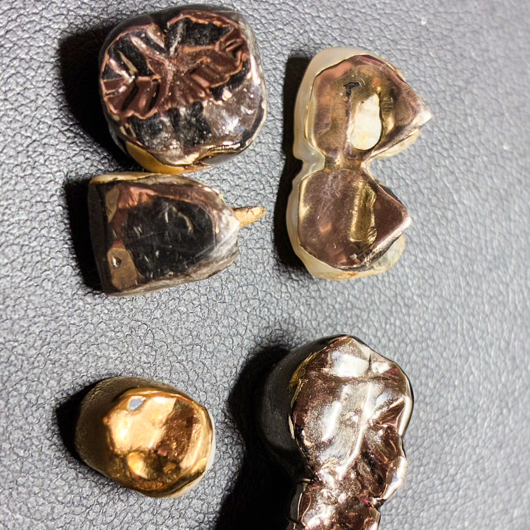 金歯・銀歯のお買取をさせていただきました！